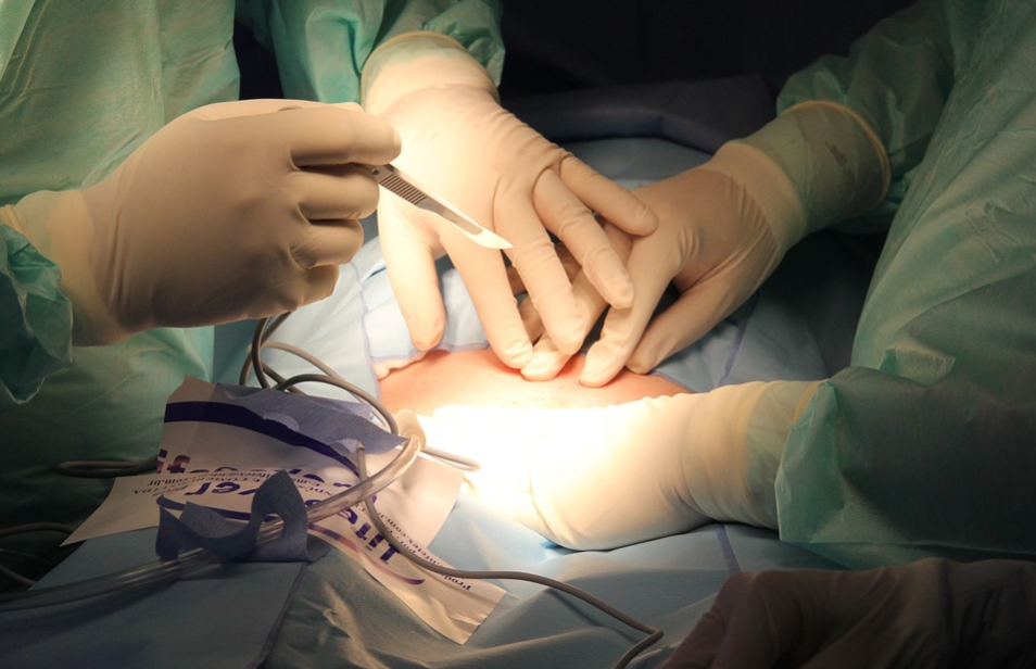breast surgery